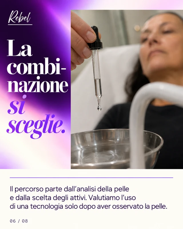 La combinazione si sceglie.